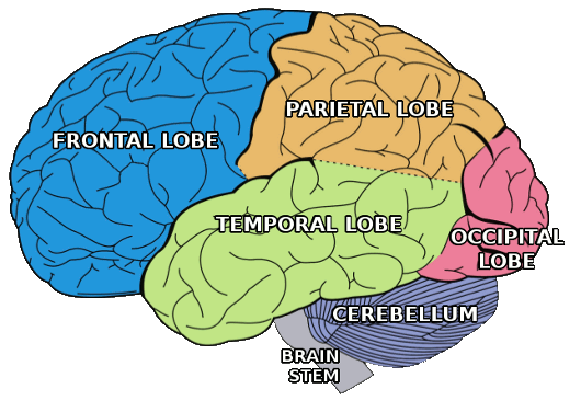 Što je moždani udar?